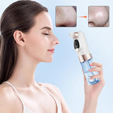 SoftSkin –Appareil de dermabrasion et nettoyage du visage