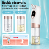 SoftSkin –Appareil de dermabrasion et nettoyage du visage